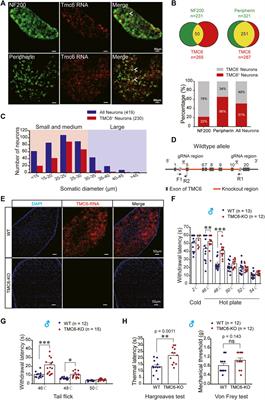 The transmembrane channel-like 6 (TMC6) in primary sensory neurons involving thermal sensation via modulating M channels